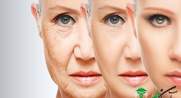 پیری زودرس