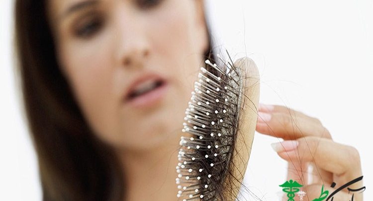 پیشگیری از ریزش مو