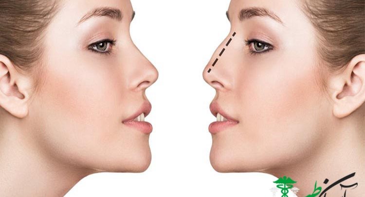 عوارض جراحی زیبایی