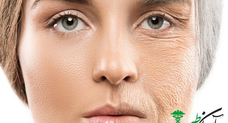 پیری زودرس