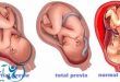 اختلالات بارداری و فوریت های پزشکی