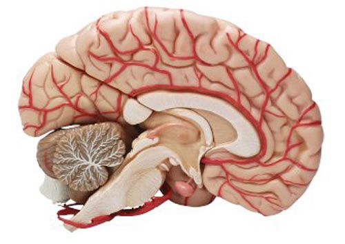 مهمترین عامل سکته مغزی و علایم سکته مغزی چیست