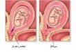 بیماری های دوران حاملگی را شناسایی کنید