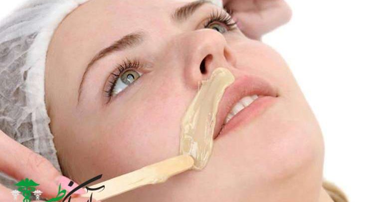 علایم موهای زاید بدن