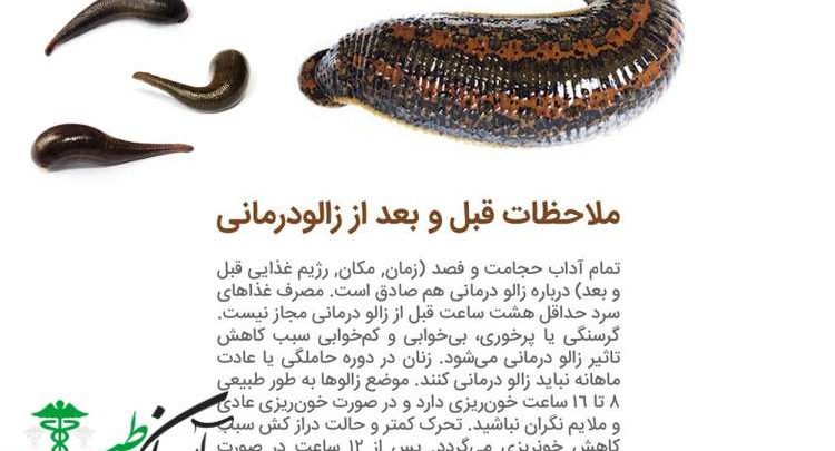 فواید زالو درمانی