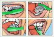 مسواک زدن صحیح دندان چگونه است ؟