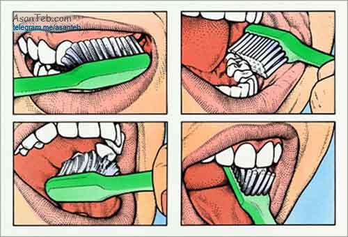 مسواک زدن صحیح دندان