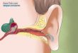 درمان ساده بیماری گوش شناگران در منزل