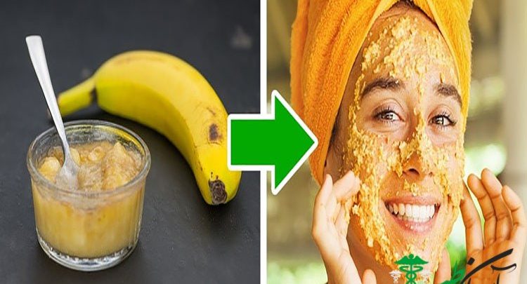 ماسک موز