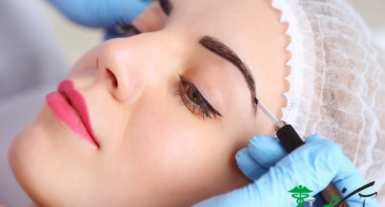 میکروپیگمنتیشن ماژیکی
