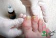 معرفی عوامل ایجاد زردی ناخن پا و روش‌های رفع آن