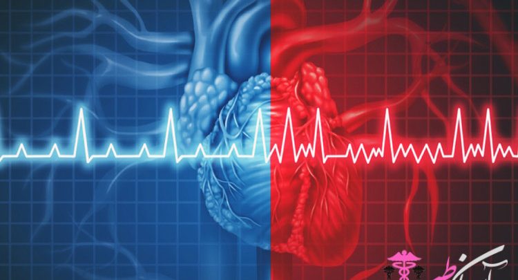 فیبریلاسیون بطنی