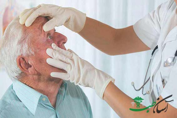 بیماری اکتروپیون