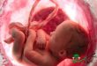 سکسکه جنین در بارداری ؛ طبیعی یا غیرطبیعی؟ 2 ویدیو