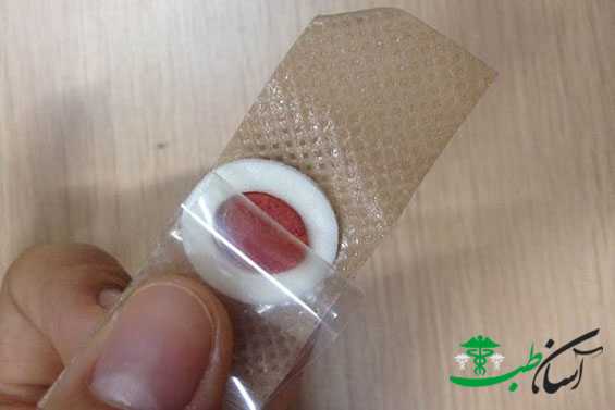 چسب میخچه چیست
